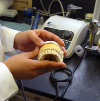 Teeth are attached to a patient's dental impression using wax.