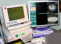 A computer and imaging software are used to capture and process data from CT scans.