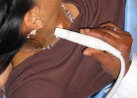 Diane Johnson places a transducer on a patient's neck that will produce an ultrasound image on the computer monitor.