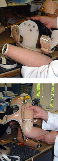 Ralph Urgolities uses a prosthetic harness with metal electrodes (top) to amplify the nerve muscle signals stimulated by chest muscle contractions. This enables the attached prosthetic arm to move (bottom).